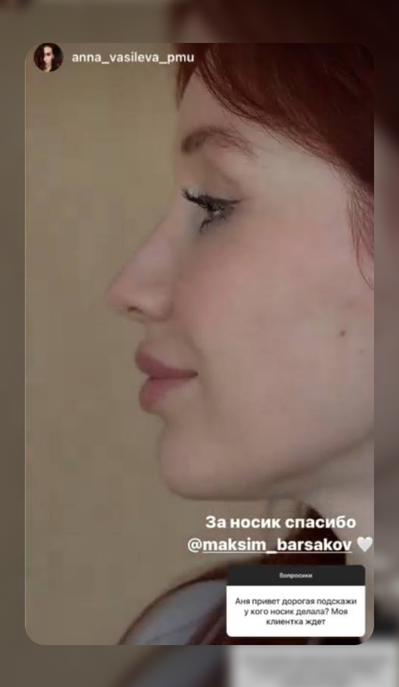 Отзыв